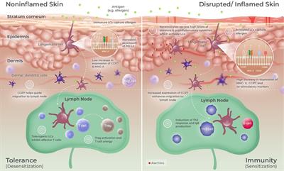 Recent advances in epicutaneous immunotherapy and potential applications in food allergy